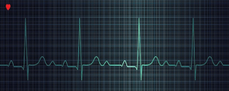 AI could detect potential heart issues