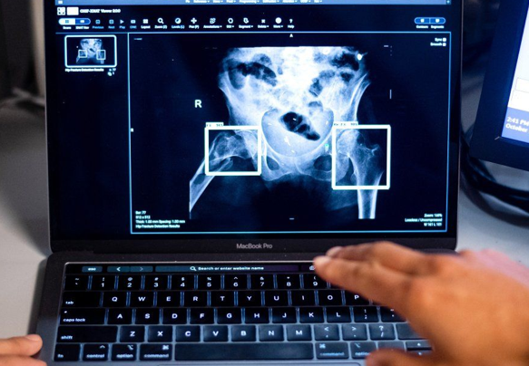 UCSF Launches Artificial Intelligence Center to Advance Medical Imaging