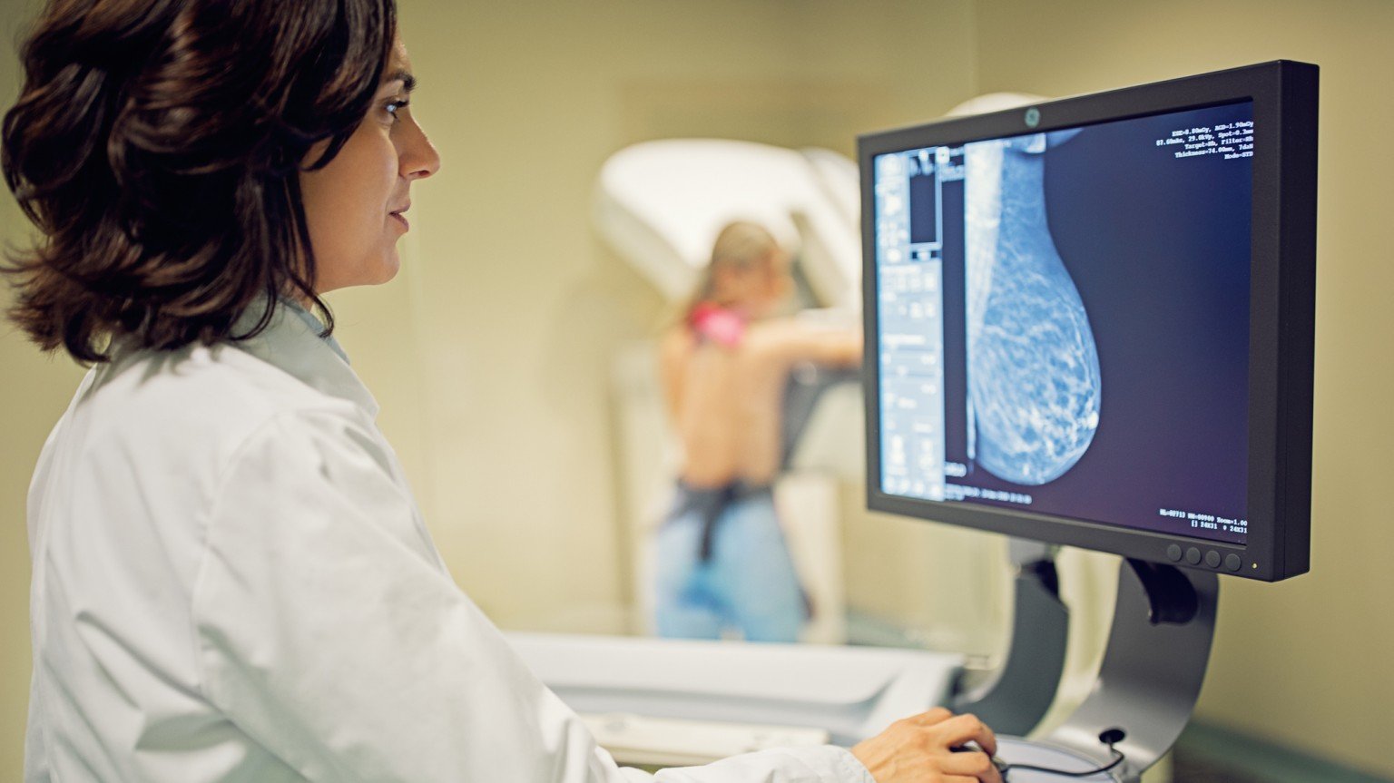 Google’s AI breast cancer screening tool is learning to generalize across countries