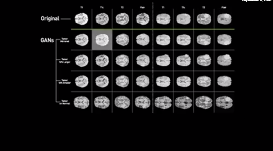 Researchers are training medical AI to combat cancer